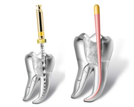 Endodonzia